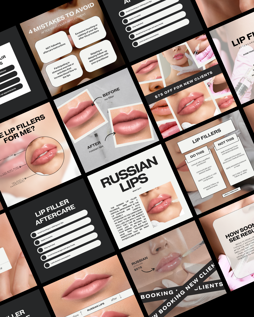 100+ MODERN AESTHETIC LIP FILLER IG TEMPLATES